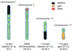 Chromosome Imbalances in Neuroblastoma—Recent Molecular Insight into Chromosome 1p-deletion, 2p-gain, and 11q-deletion Identifies New Friends and Foes for the Future 