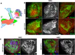 Patient-associated mutations in Drosophila Alk perturb neuronal differentiation and promote survival 
